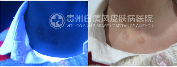 解下“白”围脖,迎接新生活