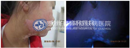 帽檐下的青春 重展双翅自由飞翔