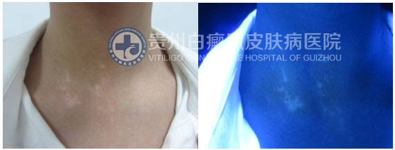 解下“白”围脖,迎接新生活