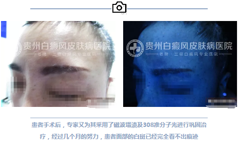 妙龄女白斑康复 赠锦旗落泪感恩