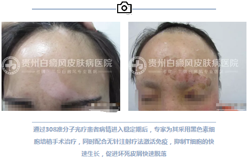 妙龄女白斑康复 赠锦旗落泪感恩